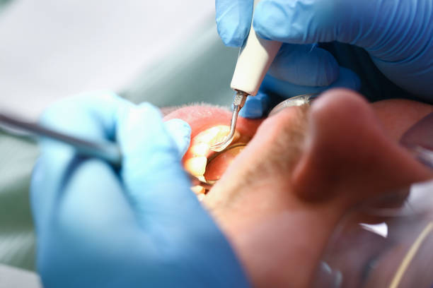 Best Walk-In Emergency Dentist in Fuquay Varina, NC
