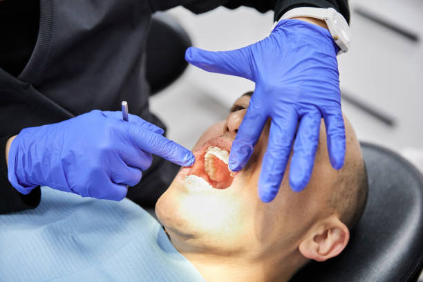Best Emergency Tooth Extraction in Fuquay Varina, NC